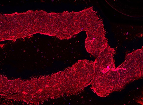 Image: co-SWIFT vessels are embedded with living smooth muscle cells and endothelial cells to replicate the structure of human blood vessels in vitro (Photo courtesy of Wyss Institute at Harvard University)