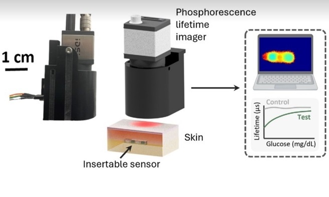 Image: The insertable glucose sensor uses a compact and cost-effective phosphorescence lifetime imager and machine learning (Photo courtesy of American Chemical Society)