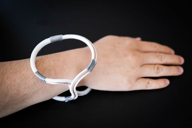 Image: A wearable jewelry-like bracelet cuts background noise to dramatically boost the power of MRI (Photo courtesy of Boston University) Image: A wearable jewelry-like bracelet cuts background noise to dramatically boost the power of MRI (Photo courtesy of Boston University)