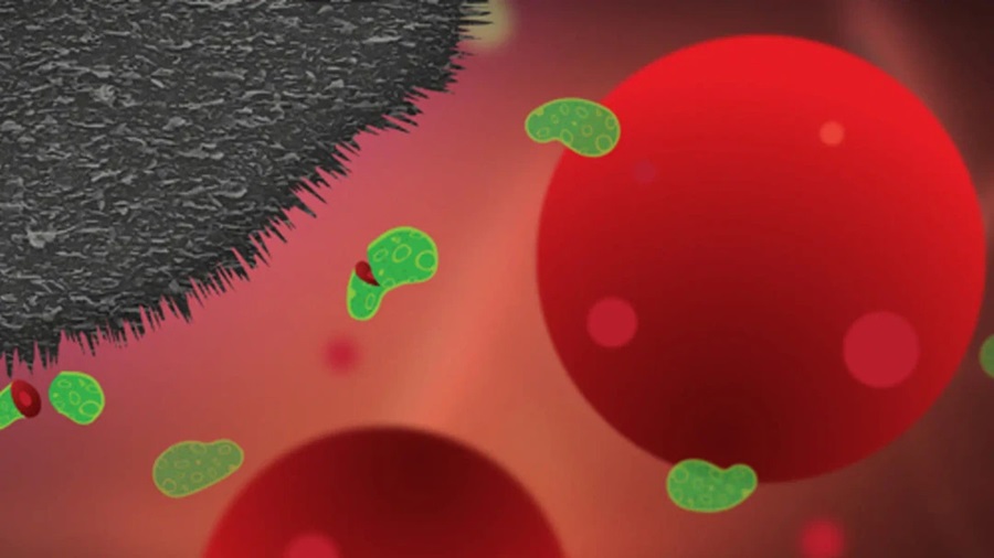 Image: Illustration of how the razor-sharp flakes of graphene line up together on a surface and can kill bacteria without harming healthy human cells (Photo courtesy of Yen Sandqvist)