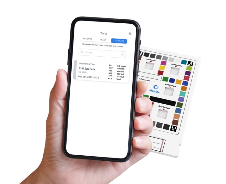 Image: The AI-powered platform improves point-of-care diagnostics with enhanced accuracy and real-time data (Photo courtesy of HueDx)