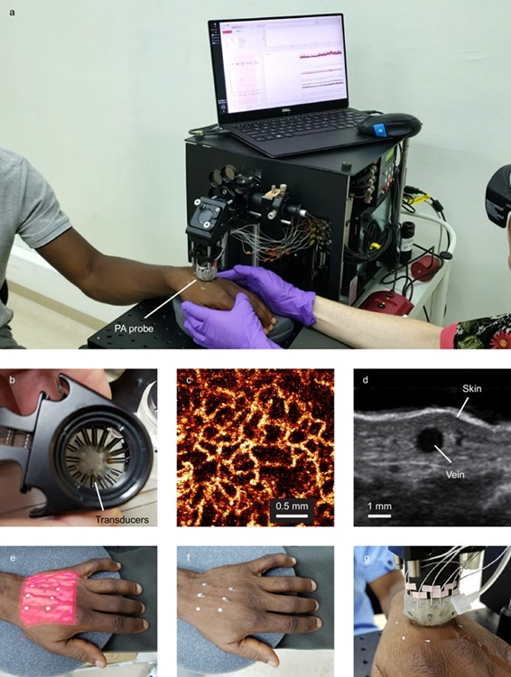 Image: The Cytophone clinical prototype (Photo courtesy of Nat. Commun.; Yadem, A.C., Armstrong, J.N., Sarimollaoglu, M. et al.)