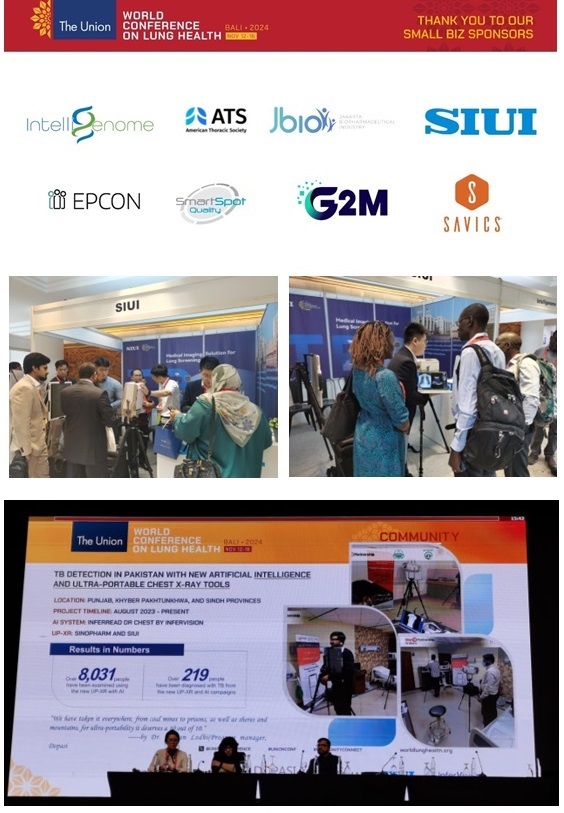 (Top Image): The Union World Conference on Lung Health gathered global experts to discuss advancements in lung health and tuberculosis prevention and treatment. (Middle): SIUI, as a recommended equipment provider for tuberculosis screening by the Global Fund, introduced the portable DR system equipped with AI diagnosis solutions for TB to tuberculosis experts from Africa and Southeast Asia. (Bottom Image): Since 2023, a non-profit organization in Pakistan focused on TB-related innovation has been utilizing SIUI’s portable TB screening solution to conduct decentralized TB screening across the country.