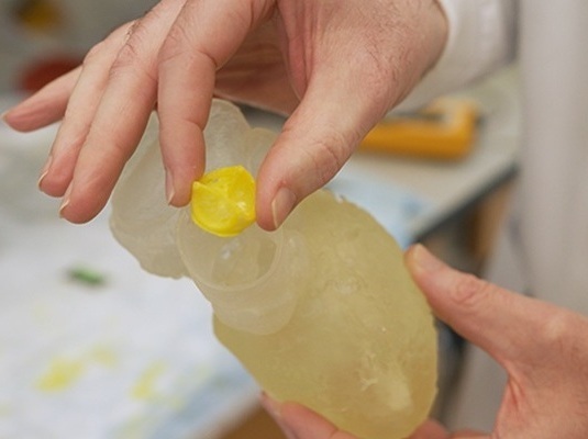 Image: The bioresorbable heart valve (yellow) that promotes tissue regeneration and a 3D-printed heart model (Photo courtesy of Georgia Tech)