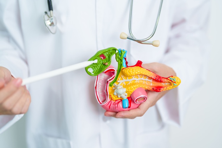 Image: The online tool to guide surgical decisions for gallbladder cancer may improve overall survival rates (Photo courtesy of Adobe Stock)