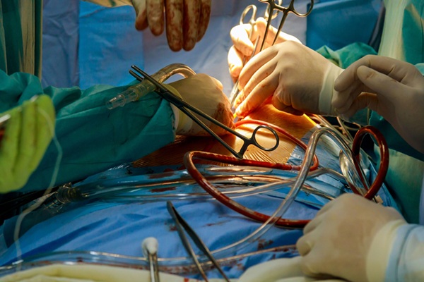 : Image: The study provided important evidence on the durability and clinical outcomes associated with the no-touch technique (Photo courtesy of Adobe Stock) : Image: The study provided important evidence on the durability and clinical outcomes associated with the no-touch technique (Photo courtesy of Adobe Stock)