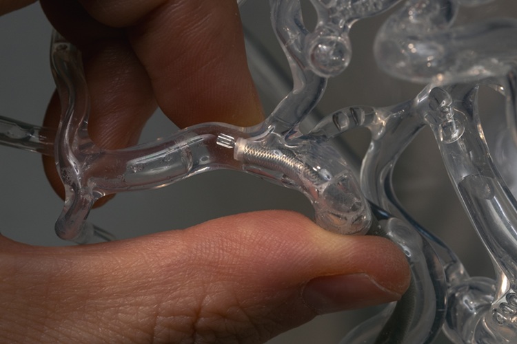 Image: The milli-spinner can shrink blood clots without rupturing them (Photo courtesy of Andrew Brodhead/Stanford) Image: The milli-spinner can shrink blood clots without rupturing them (Photo courtesy of Andrew Brodhead/Stanford)