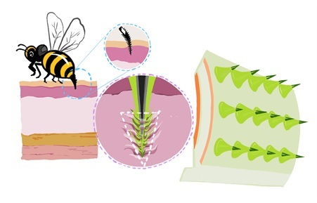 Image: The new wearable microneedles could improve drug absorption and reduce pain in long-term delivery (Photo courtesy of Professor Wonku Kang/Chung-Ang University) Image: The new wearable microneedles could improve drug absorption and reduce pain in long-term delivery (Photo courtesy of Professor Wonku Kang/Chung-Ang University)