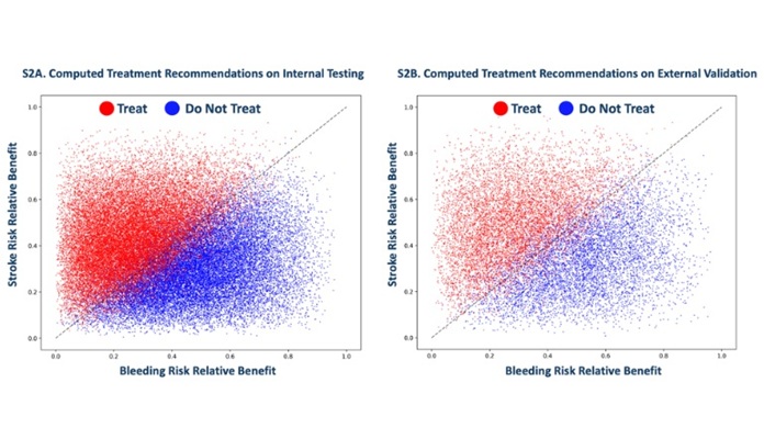 mage: Computed treatment recommendations aligning with stroke prevention and mitigating bleeding events both on internal and external validation (Photo courtesy of Mount Sinai Health System)
