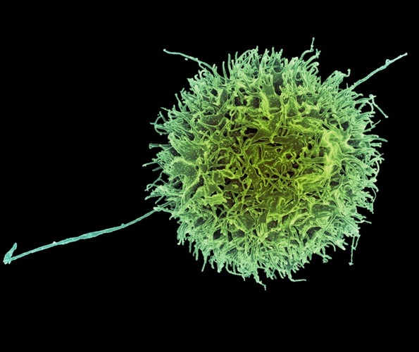 Image: The study identified genetic modifications that make “natural killer” cells more effective at destroying cancer cells (Photo courtesy of NIAID) Image: The study identified genetic modifications that make “natural killer” cells more effective at destroying cancer cells (Photo courtesy of NIAID)