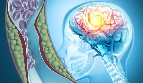 Image: The tool uses laser technology to diagnose stroke and brain injury (Photo courtesy of 123RF) Image: The tool uses laser technology to diagnose stroke and brain injury (Photo courtesy of 123RF)