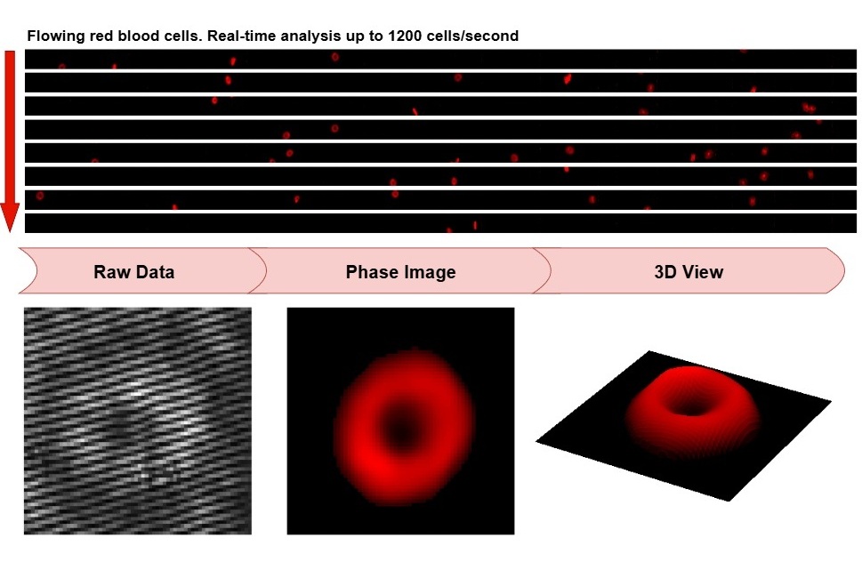 Image: Flowing red blood cells are imaged under the high-throughput QPM (Photo courtesy of W. Wang et al./Duke University) Image: Flowing red blood cells are imaged under the high-throughput QPM (Photo courtesy of W. Wang et al./Duke University)