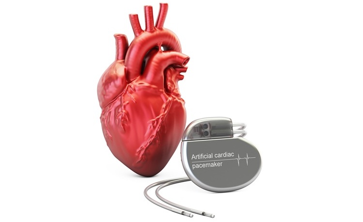 Image: The modelling tool identifies which pacemaker functions drain the most power (Photo courtesy of 123RF) Image: The modelling tool identifies which pacemaker functions drain the most power (Photo courtesy of 123RF)
