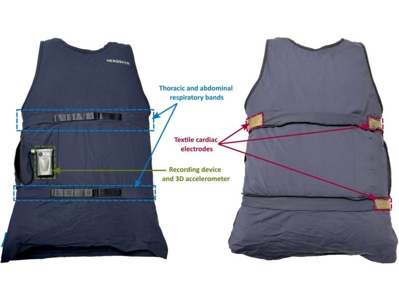Image: The Hexoskin biometric shirt features electrocardiogram sensors, thoracic and abdominal respiratory bands, 3-axis accelerometer and recording device (St-Jean J. et al., Epilepsia Open (2025). DOI: 10.1002/epi4.70099)