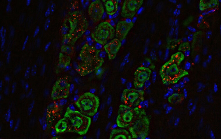 Image: The medicine is based on a spherical nucleic acid, a nanomaterial (labeled red) that travels along a nerve (green) from the nose to the brain (Photo courtesy of Alexander Stegh/WashU)