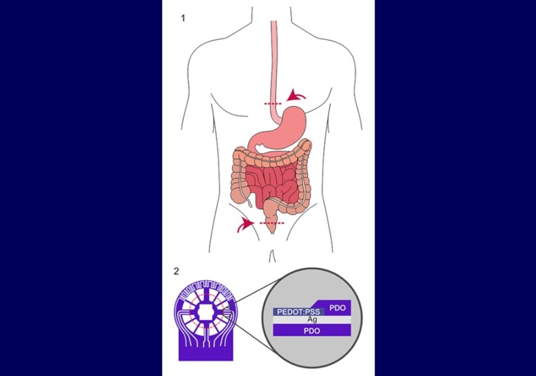 Image: The sensor film placed directly into an intestinal suture can monitor healing (Photo courtesy of D. Wahl, F. Jaekel, J. Henne, et al.)