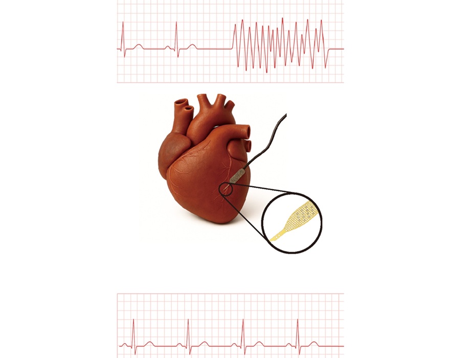 Image: Flexible mesh nanoelectronics record local electrical activity, revealing arrhythmias after hiPSC‑CM transplantation (Photo courtesy of Liu Lab/Harvard)