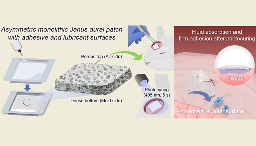 Image: The light-activated Janus patches also hold great potential for various applications beyond neurosurgery (Kang, et al. Chemical Engineering Journal, 2026; DOI: 10.1016/j.cej.2025.171881)