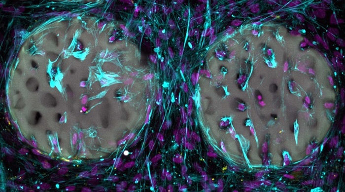 Image: Bone-forming cells (light blue) with nuclei (purple) have already colonised a hydrogel-based bone structure (gray) (Image: Margherita Bernero / ETH Zurich)