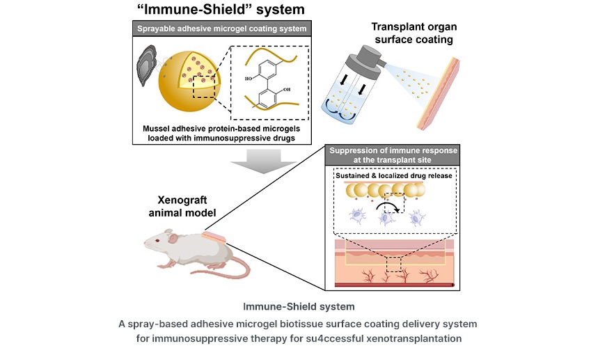 Image: The microgel coating delivers immunosuppressants directly to transplanted organs to reduce rejection risk (Photo courtesy of POSTECH)