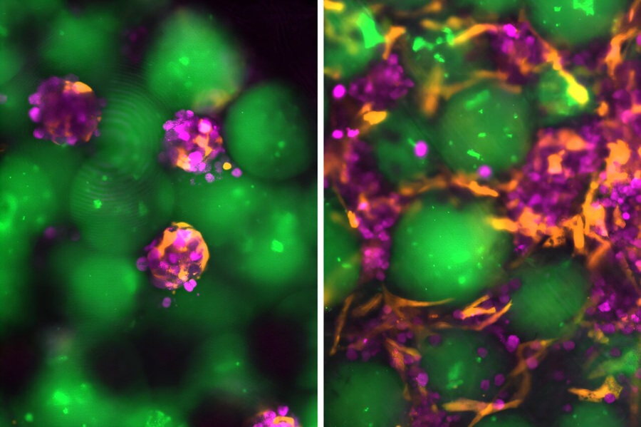 Image: The microspheres (green), hepatocytes (magenta), and supporting fibroblasts (orange) assemble and reorganize into engineered liver grafts over time. Image shows a comparison of day zero (left) and day fourteen (right) of the grafts cultured in the laboratory (Photo couresy of Bhatia Lab)