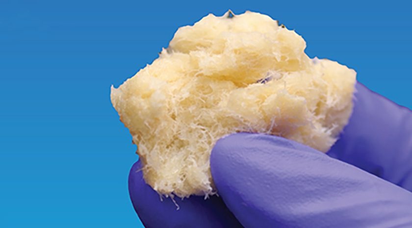 Image: DBX Fiber, introduced by MTF Biologics in collaboration with Kolosis BIO, is the latest addition to the DBX family (photo courtesy of MTF Biologics)