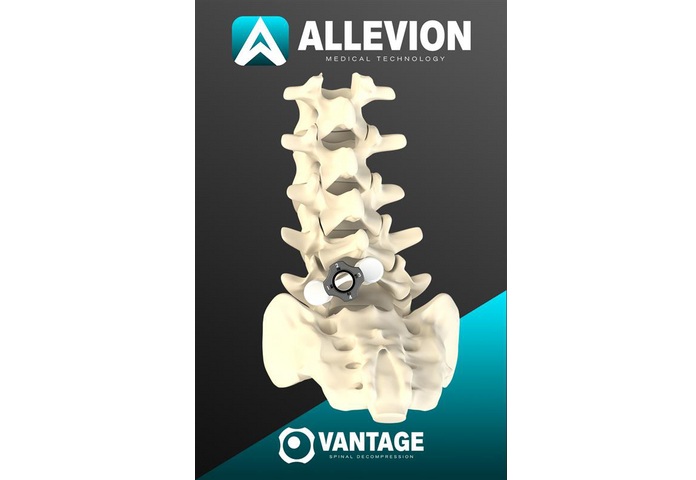 Image: Allevion Medical receives FDA Clearance for Vantage, introducing a fully disposable approach to minimally invasive spinal decompression (photo courtesy of Allevion Medical)
