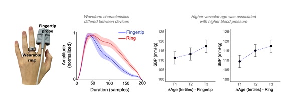 Image: Despite differences in how the ring and the clinical fingertip sensor capture pulse waveforms, the deep learning model predicted vascular age with similar accuracy from both devices. Importantly, ring-derived estimates were associated with blood pressure, a standard cardiovascular health marker (photo courtesy of NUS Medicine)