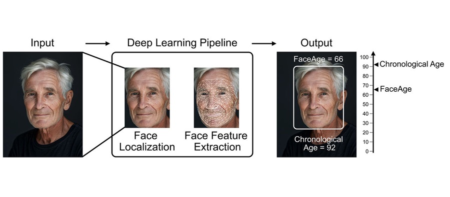 Image: Representation of how FaceAge might be calculated from a photo of a patient. The patient in this photo is AI-generated (photo couresy of Mass General Brigham)