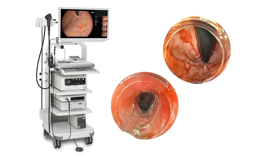 Image: The ELUXEO 8000 is a single-unit processor and light source designed to enhance image quality, therapeutic capabilities, and workflow (photo courtesy of Fujifilm) Image: The ELUXEO 8000 is a single-unit processor and light source designed to enhance image quality, therapeutic capabilities, and workflow (photo courtesy of Fujifilm)