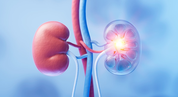 Image: The pioneering trial is the first to show that CAR T cells can help patients previously unable to receive a compatible donor kidney (image credit: Adobe Stock)
