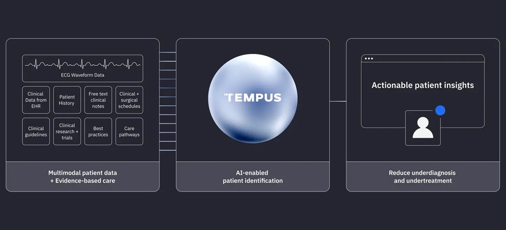 Image: Tempus ECG-AI devices pair with advanced cardiology algorithms to detect signs of certain cardiovascular conditions and notify care teams for follow-up (Photo courtesy of Tempus AI)