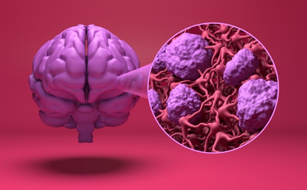 Image: Safer, more reliable blood-brain barrier disruption could expand therapeutic delivery to the brain (Image credit: iStock) Image: Safer, more reliable blood-brain barrier disruption could expand therapeutic delivery to the brain (Image credit: iStock)