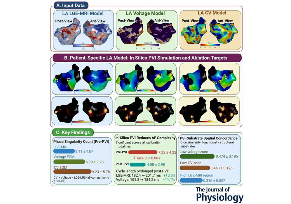 Image: Comparative multimodal calibration of patient-specific atrial fibrillation models: Impact of imaging and electrophysiology data on arrhythmogenic substrate identification (Mahmoud Ehnesh et al., The Journal of Physiology (2026). DOI: 10.1113/jp290765)