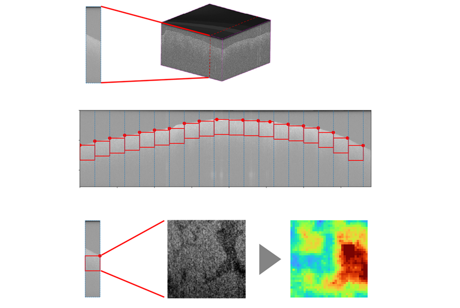 Image: The three-dimensional scan is divided into a series of two-dimensional images, which are then broken down into smaller sections along the tissue surface. The AI algorithm assesses for each of these sections how much the tissue differs from healthy tissue (Photo courtesy of Fraunhofer Austria) Image: The three-dimensional scan is divided into a series of two-dimensional images, which are then broken down into smaller sections along the tissue surface. The AI algorithm assesses for each of these sections how much the tissue differs from healthy tissue (Photo courtesy of Fraunhofer Austria)