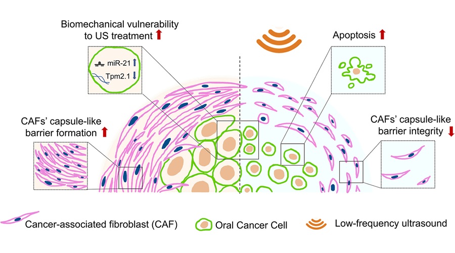Image: Graphical Abstract (Rashmita Luha et al., Revealing biomechanical vulnerabilities in oral cancer cells using 3D coculture platform and low-frequency ultrasound, Materials Today Bio (2026). DOI: 10.1016/j.mtbio.2026.103375) Image: Graphical Abstract (Rashmita Luha et al., Revealing biomechanical vulnerabilities in oral cancer cells using 3D coculture platform and low-frequency ultrasound, Materials Today Bio (2026). DOI: 10.1016/j.mtbio.2026.103375)