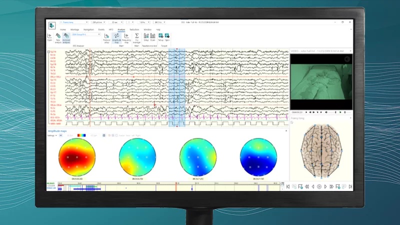 Image: Natus Medical has added the autoSCORE analysis tool to the latest update of BRAIN QUICK Software (Photo courtesy of Natus Medical) Image: Natus Medical has added the autoSCORE analysis tool to the latest update of BRAIN QUICK Software (Photo courtesy of Natus Medical)