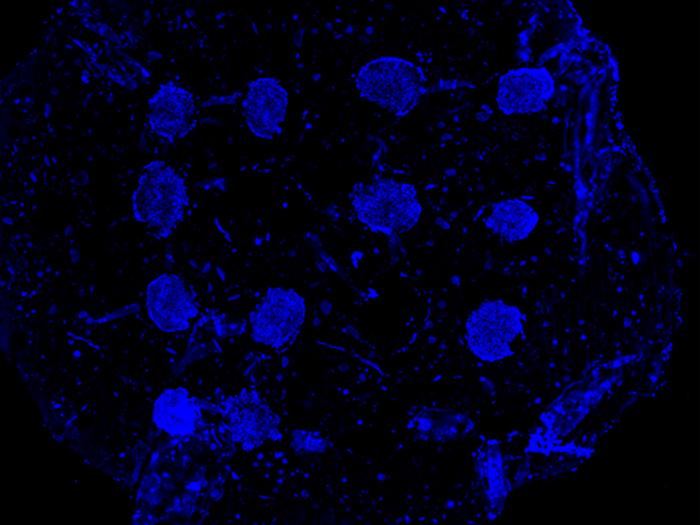Image: The figure shows a photo of the team’s spheroids taken using immunofluorescence imaging, a type of microscopy that allows biologists to view specific proteins or molecules inside a cell or tissue. A total of 16 spheroids, although some are not visible in the figure, are positioned in a microgel structure using a specialized form of 3D printing. In their work, a team of researchers demonstrated that these spheroids can help support the formation of new blood vessels in regenerated bone tissue. (Photo courtesy of Ibrahim Ozbolat/Daniel Hayes)