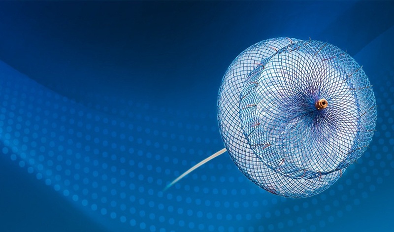 Image: Abbott’s Amulet 360 helps seal the left atrial appendage, reducing stroke risk and the need for blood-thinning medication in AFib patients (Photo courtesy of Abbott)