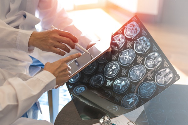 Image: A new study compared three deep learning methods to determine which most accurately delineates stroke lesions on contrast-free MRI in routine clinical imaging (Image Credit: iStock)