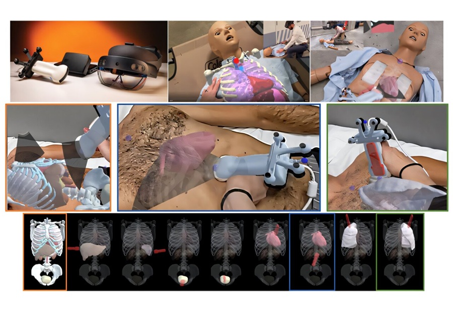 Image: Anatomically guided sonography for trauma assessment includes a mixed reality headset (e.g., top left). Example views show virtual augmentation overlays for anatomy registration and ultrasound probe guidance on a test surrogate. The anatomical display is customized based on the organ or region being targeted with the ultrasound probe. (Robert S. Armiger, Anna E. Knight, Catherine M. Carneal, et al. Journal of Medical Imaging (2026). DOI: 10.1117/1.jmi.13.4.045001) Image: Anatomically guided sonography for trauma assessment includes a mixed reality headset (e.g., top left). Example views show virtual augmentation overlays for anatomy registration and ultrasound probe guidance on a test surrogate. The anatomical display is customized based on the organ or region being targeted with the ultrasound probe. (Robert S. Armiger, Anna E. Knight, Catherine M. Carneal, et al. Journal of Medical Imaging (2026). DOI: 10.1117/1.jmi.13.4.045001)