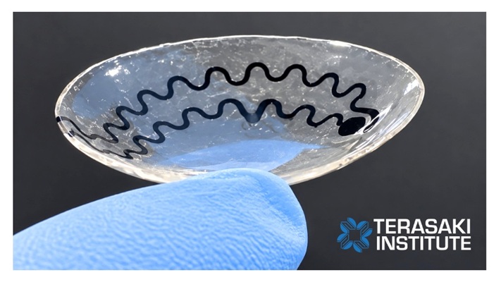 Image: A reusable, soft contact lens developed at the Terasaki Institute for Biomedical Innovation offers a noninvasive way to measure the stress-linked hormone serotonin directly from tears. (Image Credit: Terasaki Institute for Biomedical Innovation) Image: A reusable, soft contact lens developed at the Terasaki Institute for Biomedical Innovation offers a noninvasive way to measure the stress-linked hormone serotonin directly from tears. (Image Credit: Terasaki Institute for Biomedical Innovation)