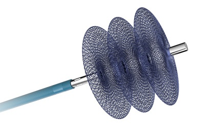 Image: LOBO is a vascular occlusion system designed to provide occlusion with controlled mechanical precision across a range of peripheral vessel anatomies (Photo courtesy of Okami Medical)