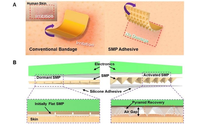 Image: Schematic Diagram of a Shape-Memory Polymer-Based Adhesive Patch: A) Schematic diagram showing reduced skin damage compared to conventional adhesives. B) Schematic illustration of the activation of the adhesive patch as the shape-memory polymer recovers. (Photo courtesy of POSTECH)