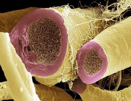 Image: Colored scanning electron micrograph of myelinated nerve fibers, showing the myelin sheath (pink), the axoplasm (dark brown), and the endoneurium (yellow) (Photo courtesy of Steve Gschmeissner / SPL).