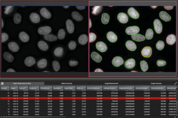 Leica Application Suite Advanced Fluorescence (LAS AF)