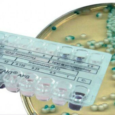 ANTIFUNGAL SUSCEPTIBILITY TEST