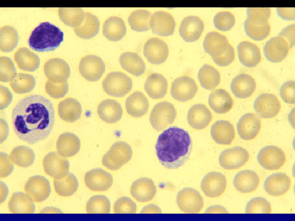 Image: Normal Blood slide (Photo Courtesy of Queen’s University).