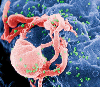 Image: Scanning electron micrograph of Human immunodeficiency virus 1 (HIV-1) budding (in green) from cultured lymphocyte (Photo courtesy of C. Goldsmith).