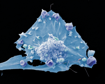 Image: Color-enhanced image of a breast cancer cell (Photo courtesy of Anne Weston).